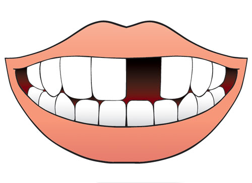 Учите английские слова на myenglishclassroom.com  absence